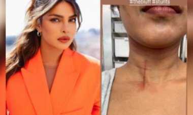 'द ब्लफ' के सेट पर स्टंट करते वक्त प्रियंका चोपड़ा की गर्दन पर आई चोट