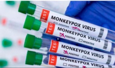 अफ्रीका में एमपॉक्स के प्रकोप को रोकने के लिए वैक्सीन की खरीद जरूरी : रिपोर्ट