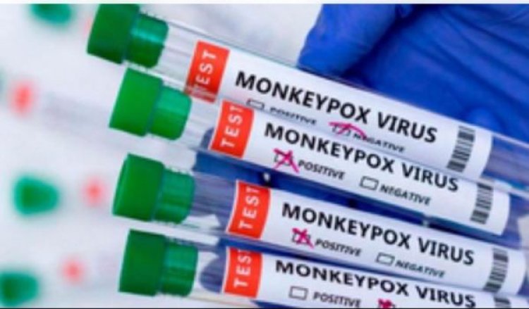 अफ्रीका में एमपॉक्स के प्रकोप को रोकने के लिए वैक्सीन की खरीद जरूरी : रिपोर्ट